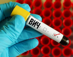 Вчені зі Стенфордського університету розробили новий тест на ВІЛ