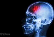 Ayuno y dietas basadas en plantas: alivio potencial para las migrañas y las lesiones cerebrales traumáticas