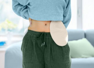 Жизнь после хирургического лечения язвенного колита: диета, прогноз и многое другое