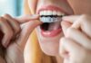 Invisalign versus brackets: una guía clara para enderezar los dientes