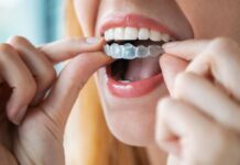 Invisalign versus brackets: una guía clara para enderezar los dientes