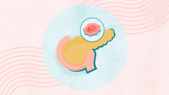 6ed0b980-0acb-4c15-98e0-16141307e8e6