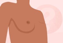 Развенчание 7 Распространённых Мифов о Мастэктомии