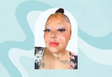 Життя з вовчаком і ревматоїдним артритом: стійкість, самозахист та довгий шлях до здоров’я