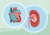 Як хронічна хвороба нирок (ХНН) впливає на здоров’я серця