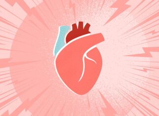 Den „Witwenmacher“ überleben: Ein Bericht aus erster Hand über Herzinfarkt, Wiederbelebung und Folgen