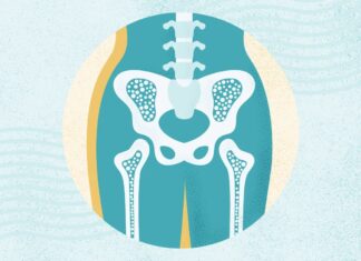 Osteoporóza: Kompletní přehled příznaků, rizik a léčby