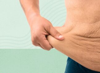 Perda de peso e excesso de pele: um guia completo