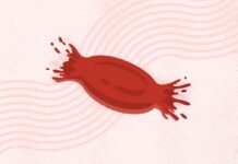 Пароксизмальна Нічна Гемоглобінурія (ПНГ): Детальний Огляд