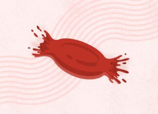 Paroxysmal Nocturnal Hemoglobinuria (PNH): Gambaran Komprehensif