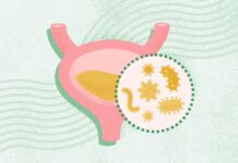 Інфекції Сечових шляхів: Повне Керівництво